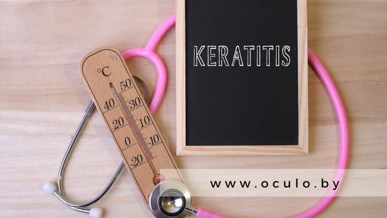 Акантамебный кератит: симптомы, стадии и лечение