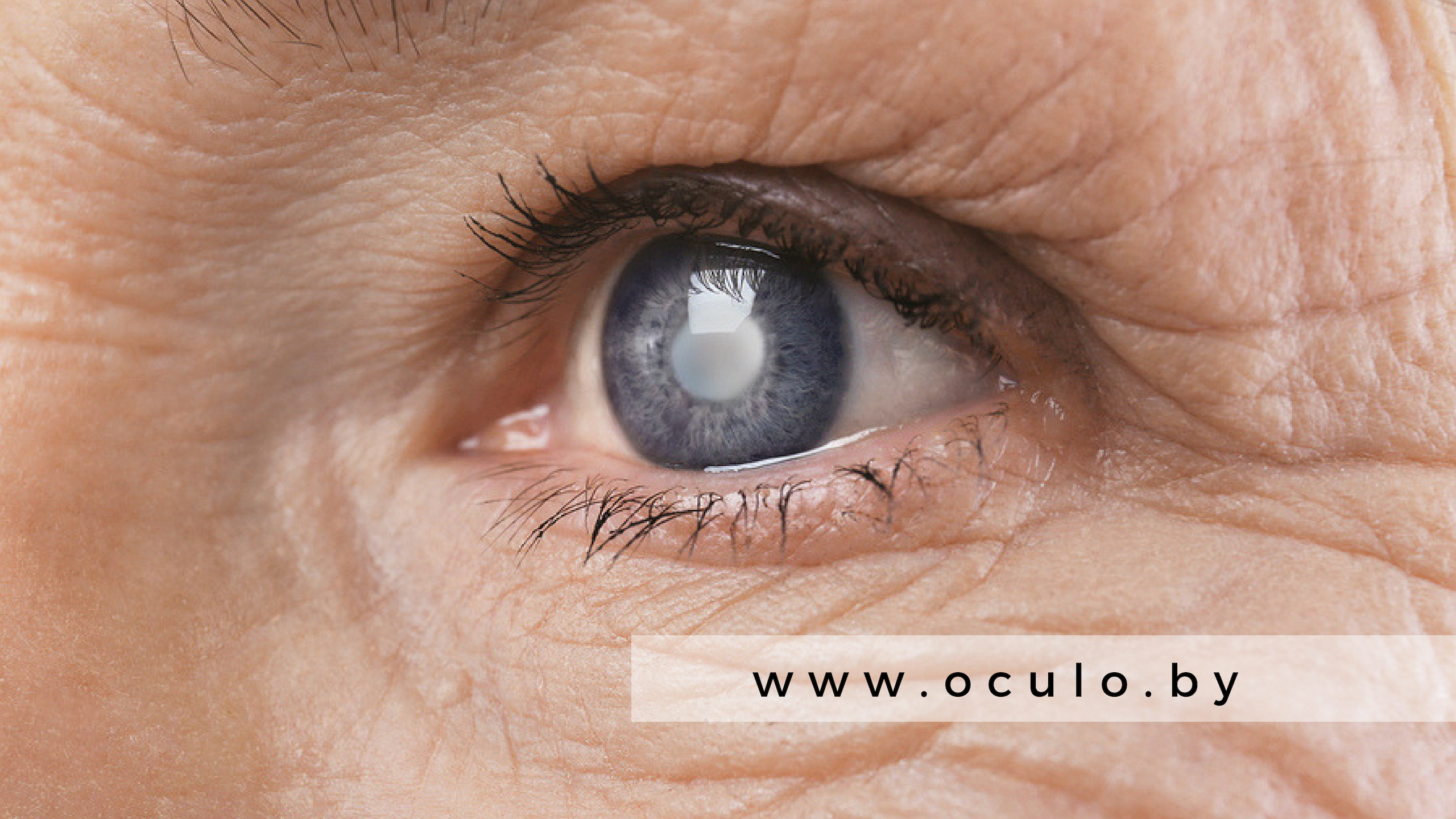 Диабетическая ретинопатия: причины, смиптомы, лечение