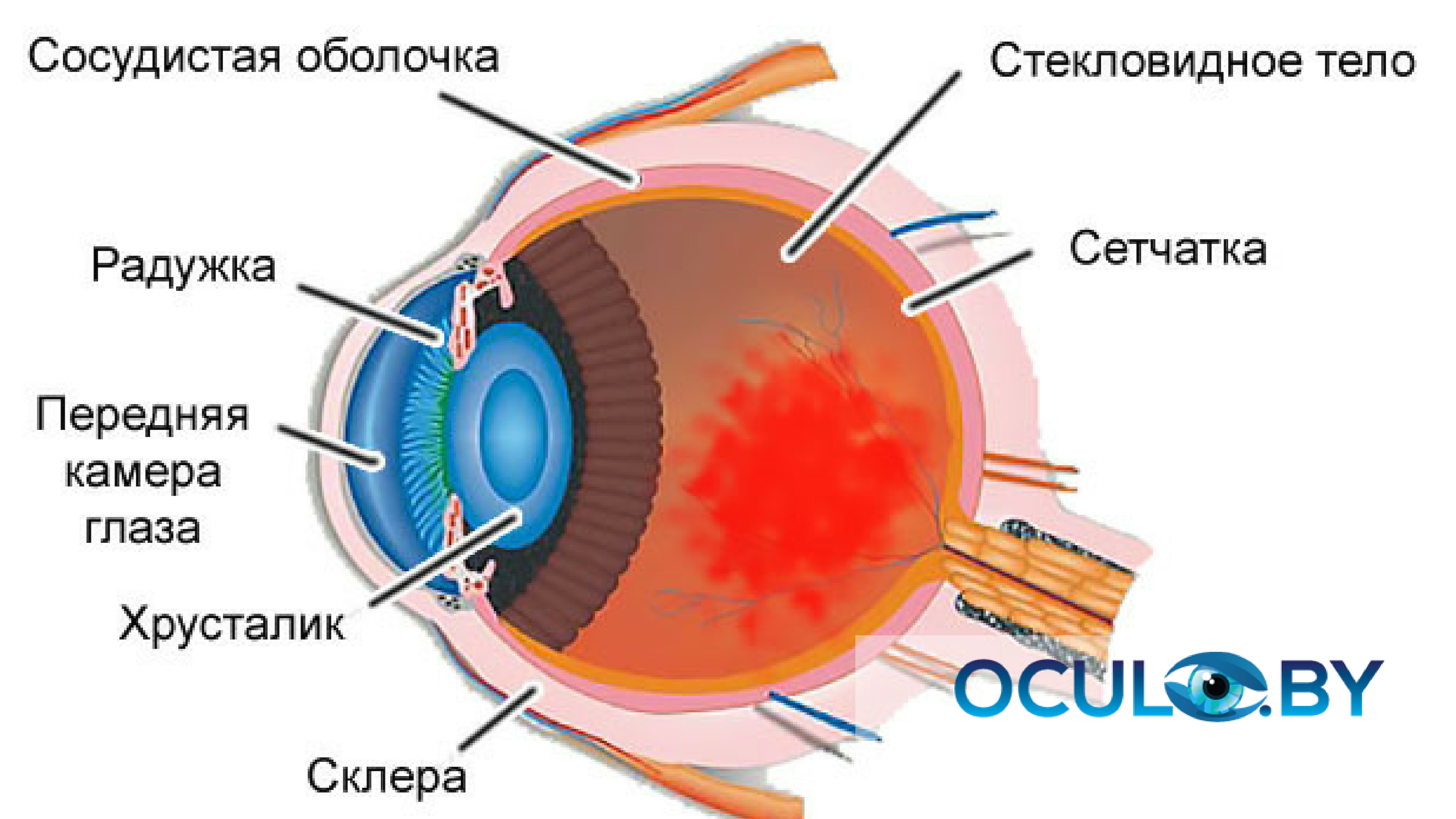 Субконъюнктивальная гематома. Подконъюнктивальный разрыв склеры. Кровоизлияние в стекловидное тело. Кровоизлияние в сетчатку глаза.