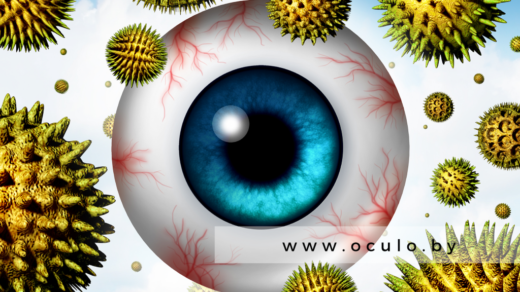 Как аллергия проявляется на глазах