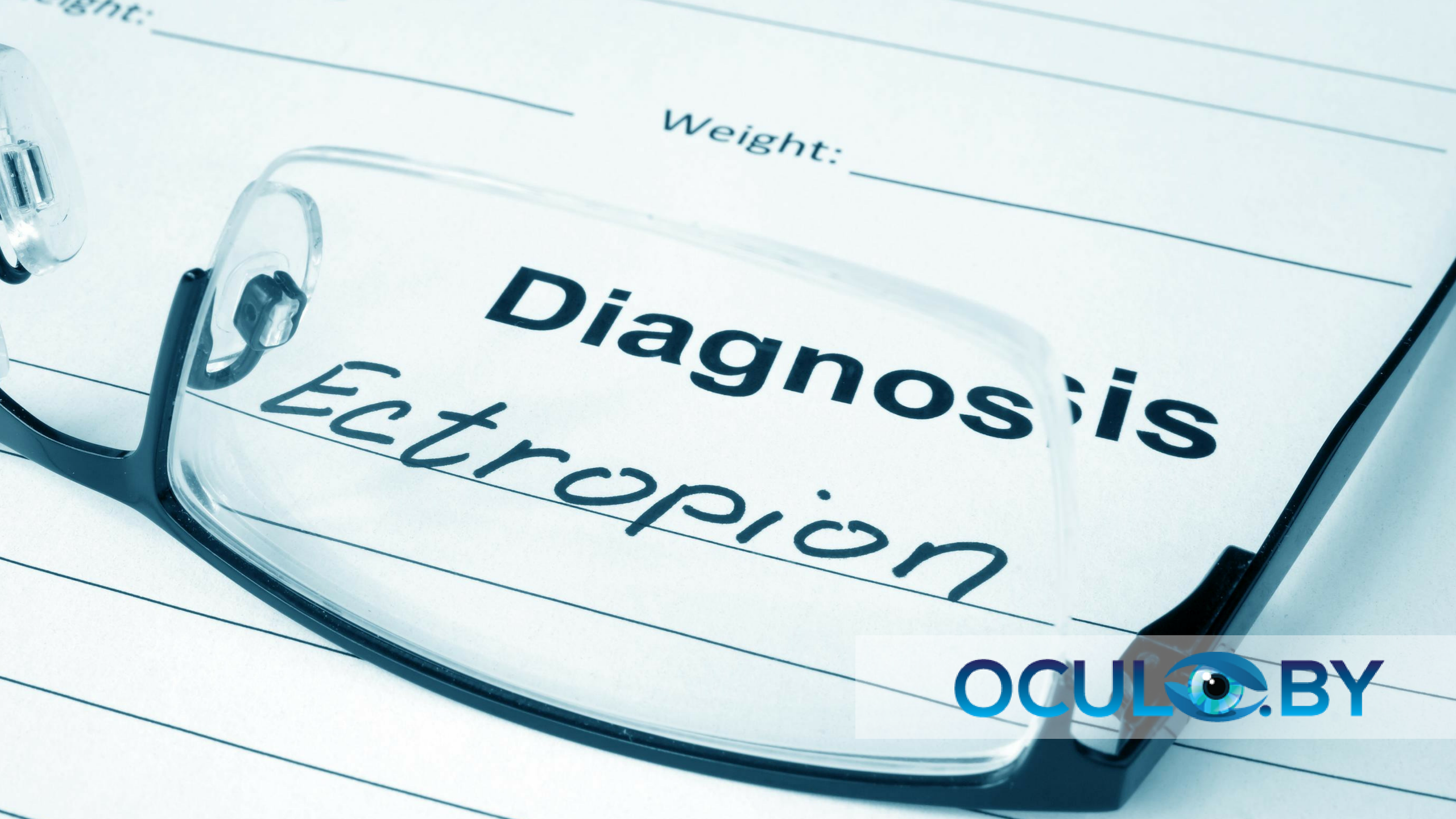 Выворот века (эктропион)